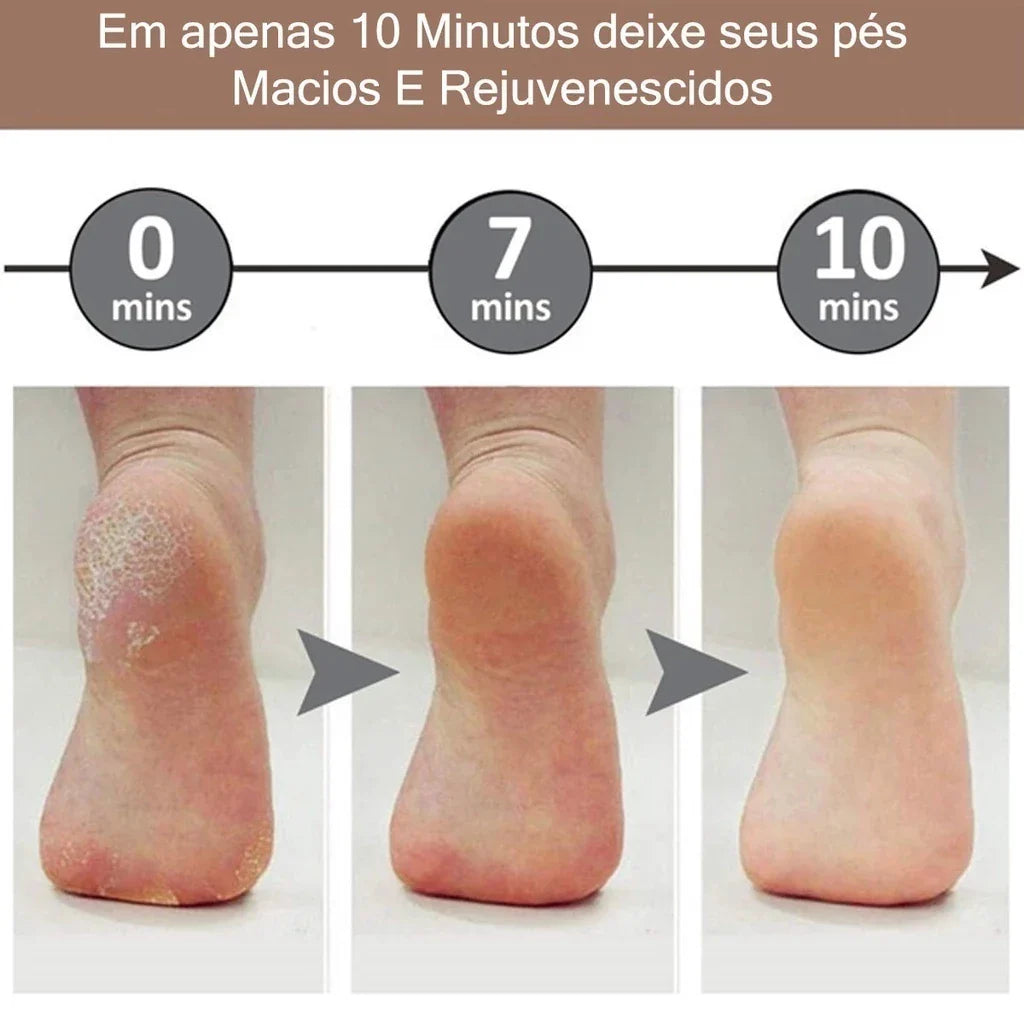Lixador de Pé Elétrico - COMPRE O LIXADOR E GANHE UM CREME HIDRATANTE